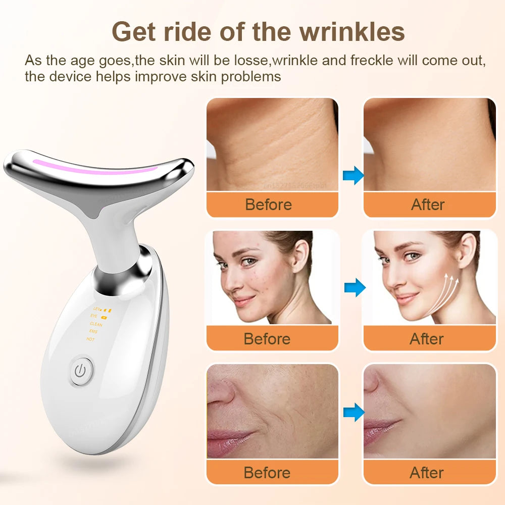 Face Lifting Machine Ems Gezichts Microcurrent Apparaat Nek Gezicht Lifting Massager Huid Strakker Anti-Rimpel Dubbele Kin Remover