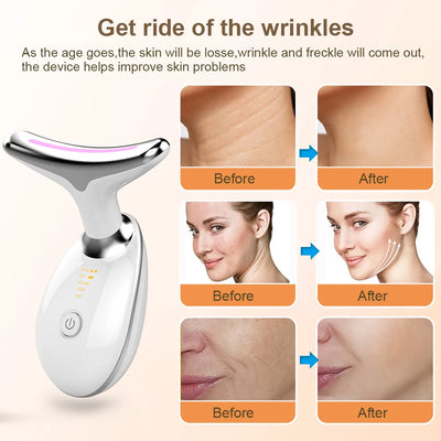 Face Lifting Machine Ems Gezichts Microcurrent Apparaat Nek Gezicht Lifting Massager Huid Strakker Anti-Rimpel Dubbele Kin Remover